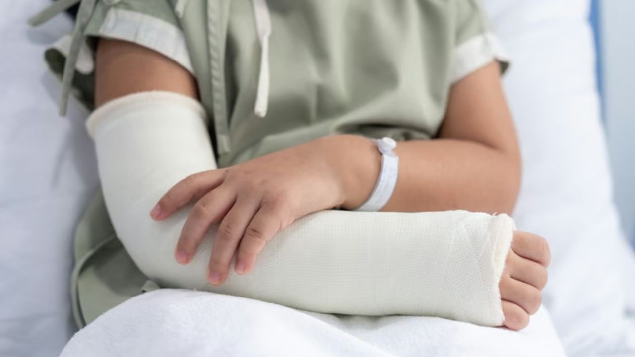 El niño tenía nueve años cuando sufrió el accidente. Tras una extensa recuperación, la Cámara reconoció una incapacidad física y fijó un resarcimiento superior a $62 millones.